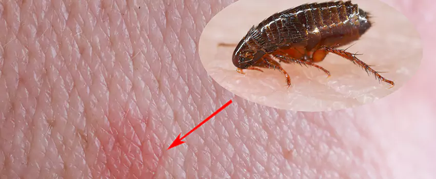 Flea Control for Humans Sachse, TX